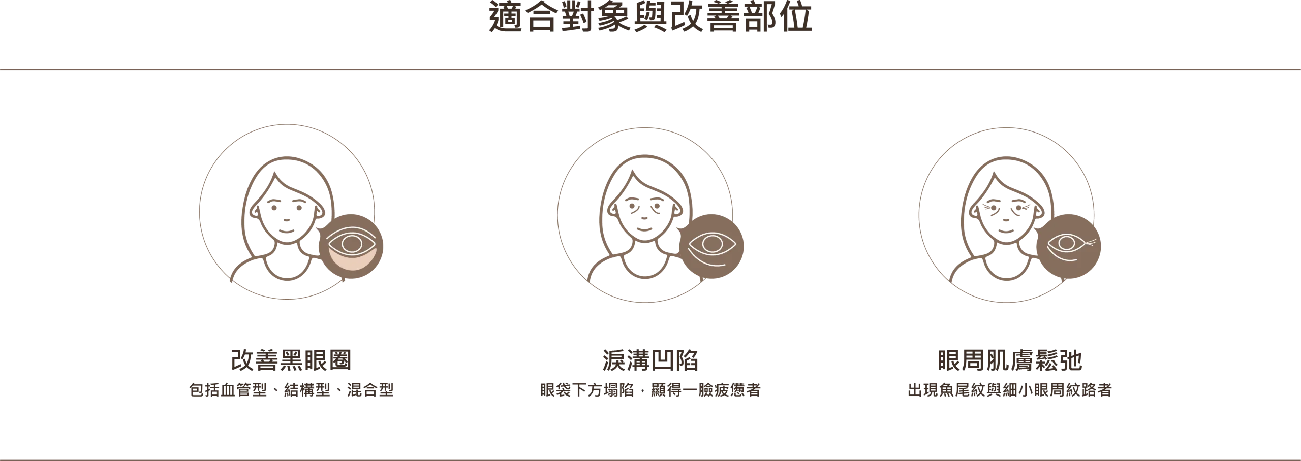 膠原蛋白熊貓針適合對象與改善部位圖示，包含改善黑眼圈（血管型、結構型、混合型）、填補疲憊感的淚溝凹陷，以及改善出現魚尾紋的眼周肌膚鬆弛問題。