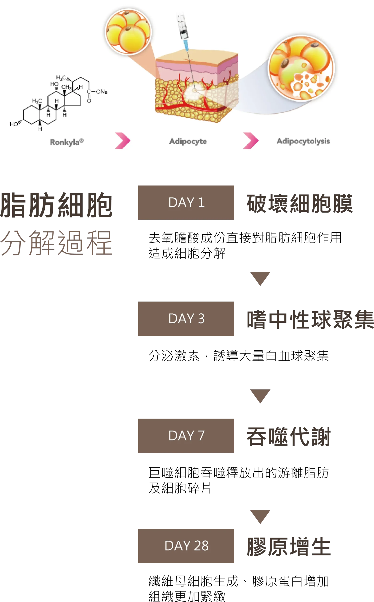 容脂針脂肪細胞分解過程示意圖。詳細說明 DAY 1 去氧膽酸破壞細胞膜、DAY 3 嗜中性球聚集、DAY 7 巨噬細胞吞噬代謝游離脂肪，以及 DAY 28 纖維母細胞與膠原蛋白增生使組織更緊緻的四階段變化。