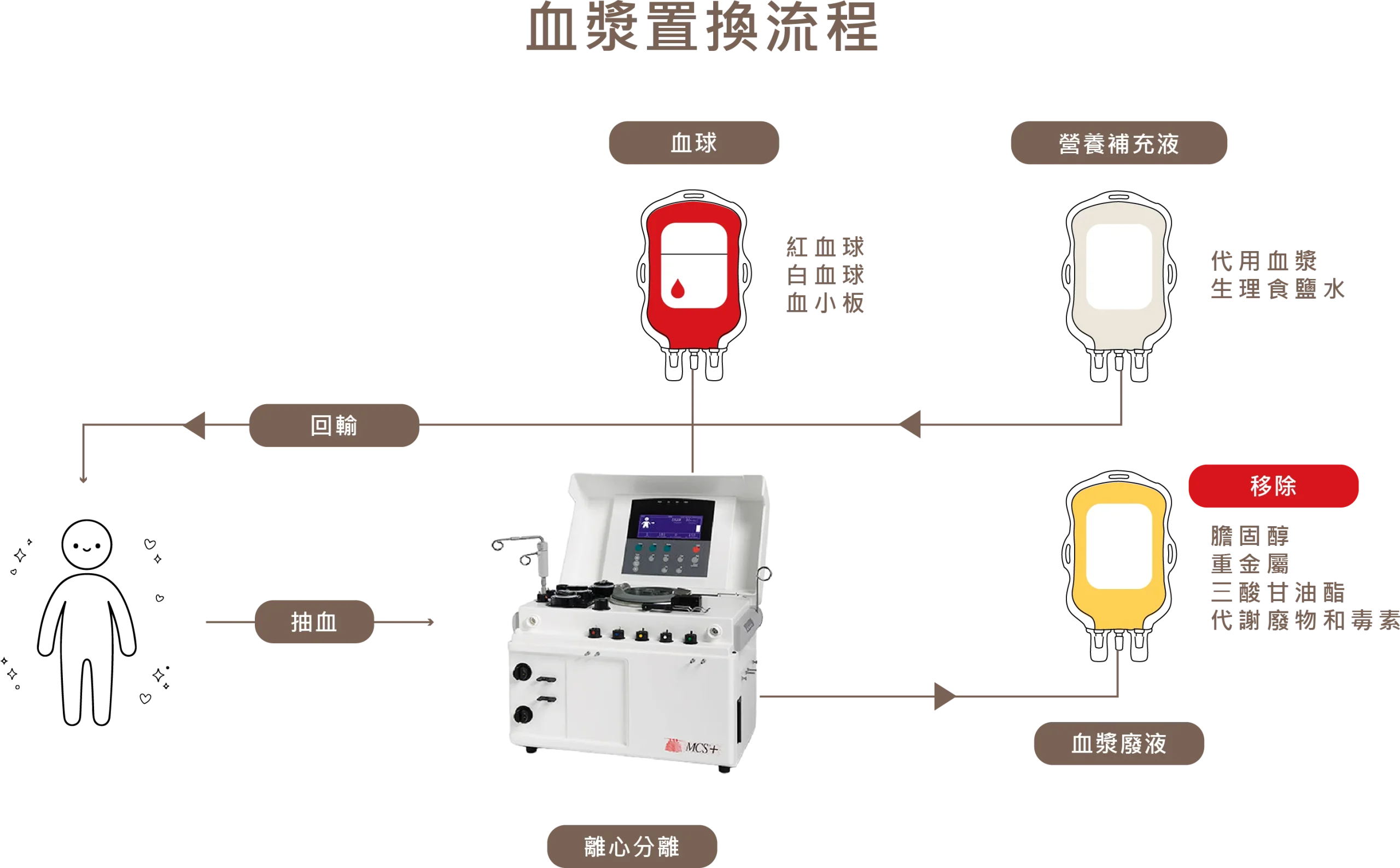 血漿置換流程圖：抽血後經離心分離機分離血球與血漿廢液，移除膽固醇、重金屬、三酸甘油酯、代謝廢物毒素，再補充營養補充液後回輸體內