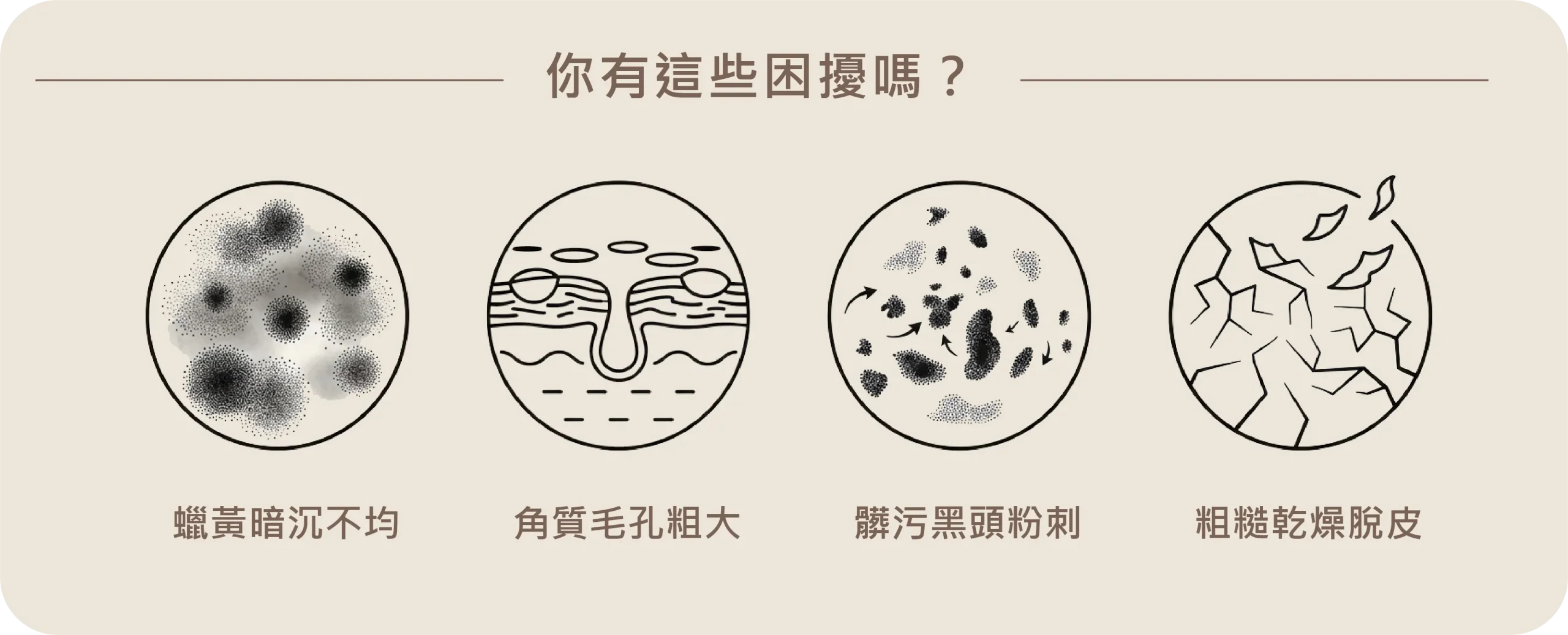 常見的四大肌膚困擾圖示：蠟黃暗沉不均、角質毛孔粗大、髒污黑頭粉刺，以及粗糙乾燥脫皮。