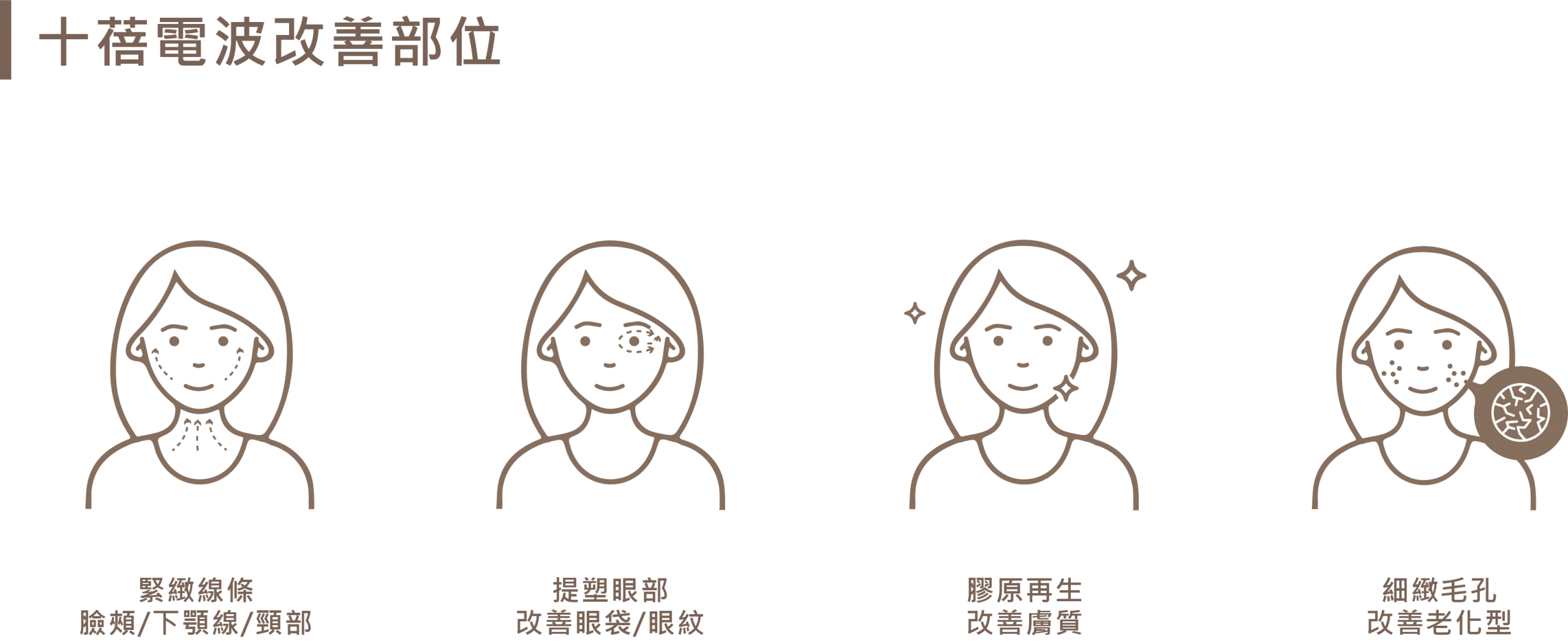 十蓓電波四大改善部位圖示：緊緻線條（臉頰、下顎線、頸部）、提塑眼部（改善眼袋與眼紋）、膠原再生（改善膚質），以及細緻毛孔（改善老化型毛孔）。